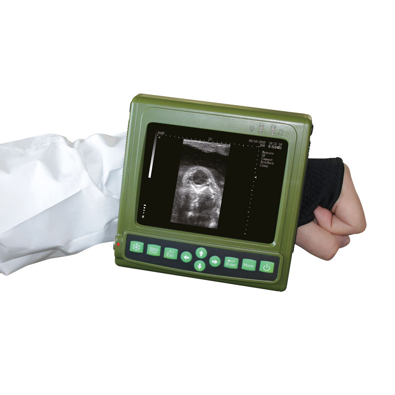 Ultralydsscanner Magic 500 Plus incl. 6,5 MHz lineær probe